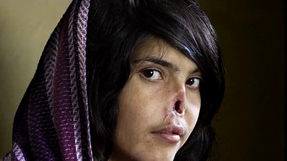 A fost mutilata de afgani, iar acum se plimba cu metroul in New York