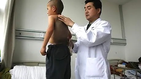 Baiatul-testos, operat pentru a scapa de „carapace”