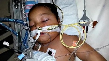 Un băiat de 3 ani a supraviețuit după ce i-au fost transplantate cinci organe