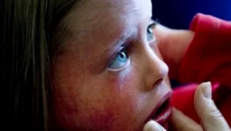 Fetita care isi schimba pielea de 14 ori pe zi!