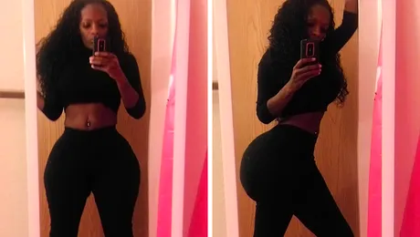 Vanity Wonder, femeia care și-a umflat fundul cu 1.000 de injecții cu silicon (Poze)