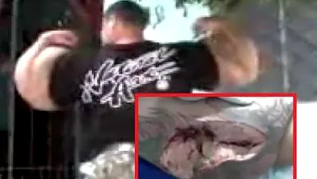 SOCANT: Un culturist a murit dupa ce i-a explodat un brat (Video)