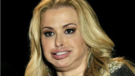 O superbă cântăreaţă, deformată de botox!