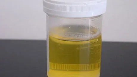 Locuitorii din Fukushima urineaza radioactiv