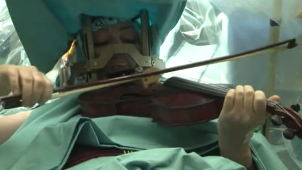 A cântat Mozart la vioară, în timpul operației pe creier - VIDEO