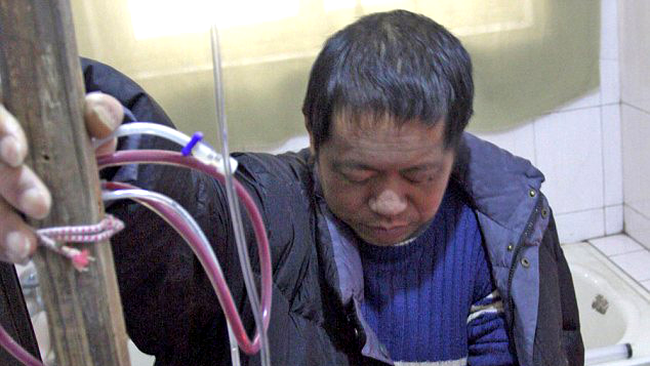 Hu, în timpul ședinței de dializă