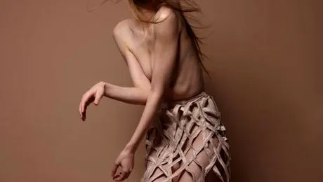 Iulia Albu sufera de anorexie?