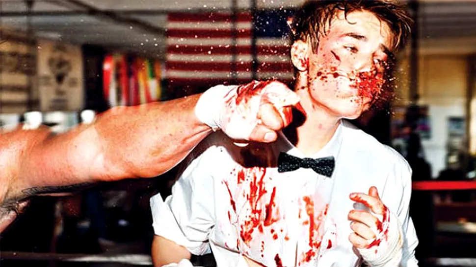 Justin Bieber, bătut până la sânge!