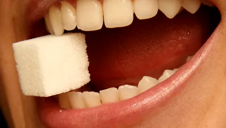 Un gel minune ar putea elimina plombarea dintilor