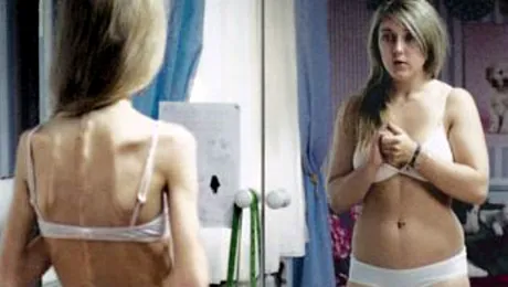 Ciudat! Idealuri de frumuseţe: dieta cu tenie şi look-ul tuberculos