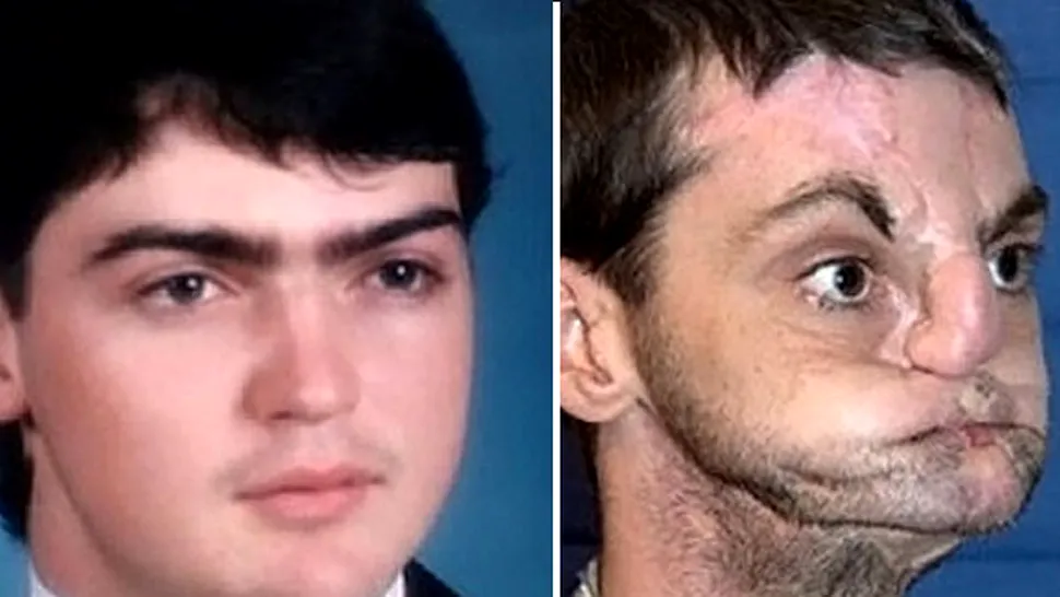 Cum arată acum bărbatul care și-a schimbat fața