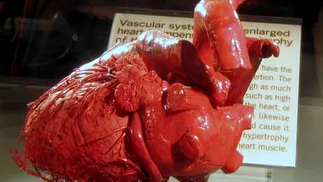 O femeie „a inviat” dupa ce a avut inima oprita 30 de minute