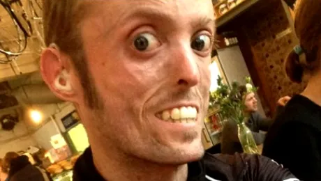 Sportivul-mumie! Suferă de o mutaţie genetică pe care o mai au doar 7 oameni în lume