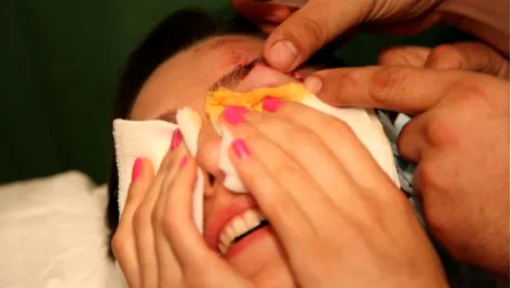 O cunoscută artistă, cu arcada spartă şi braţul rupt. Ipostaze şocante – FOTO