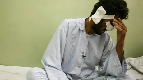 Talibanii i-au taiat nasul si urechile pentru ca a votat (POZE)