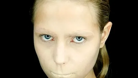 O femeie și-a lipit buzele accidental