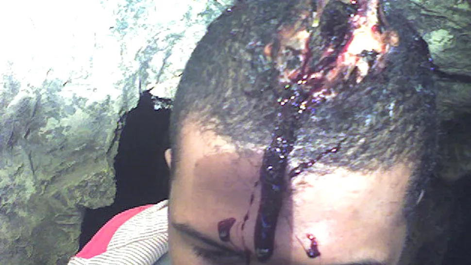 Cabral, plin de sange si cu capul spart in urma unui accident
