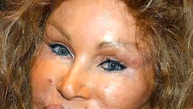Jocelyn Wildenstein