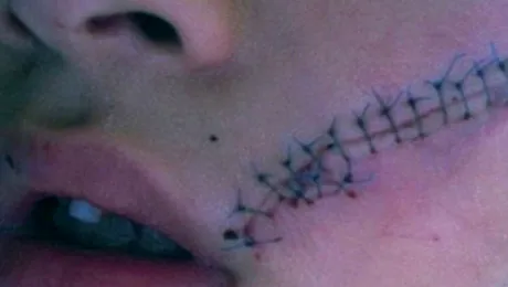 Desfigurat pentru că a vrut o Cola rece