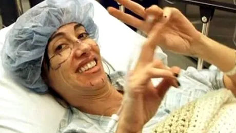 Operația de selfie a costat-o 15.000 de dolari! Video