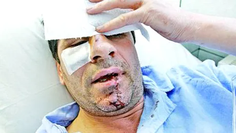 Vedete de la noi care au fost batute!