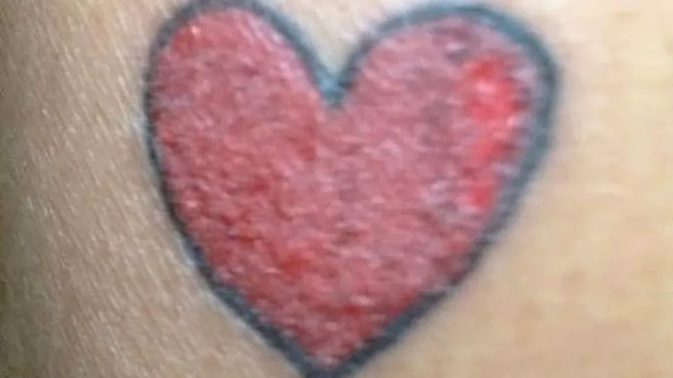 Ce a pățit o femeie după ce și-a făcut tatuaj pe gleznă