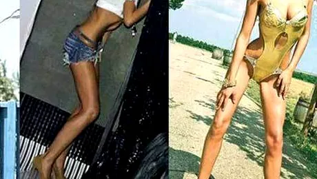 Vedetele anorexice din showbiz-ul românesc