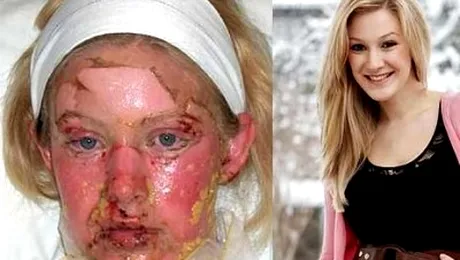 Pastila de paracetamol a transformat-o intr-un monstru