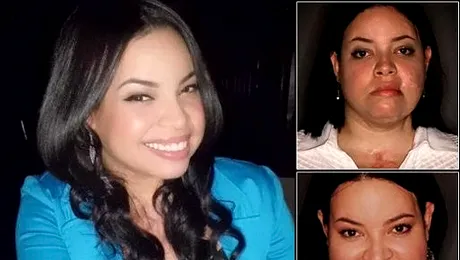 Noua față a femeii care a supraviețuit unui atac oribil