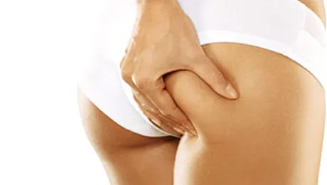 Spune adio celulitei!