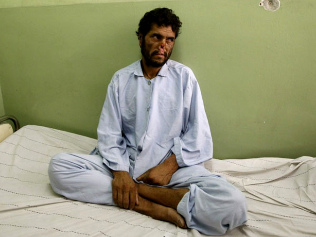 Mohammad a fost mutilat