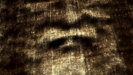 Chipul lui Iisus a aparut pe radiografia unei bolnave de cancer