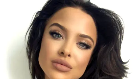 A devenit celebră şi strâns o avere după ce şi-a făcut o mică intervenţie estetică!