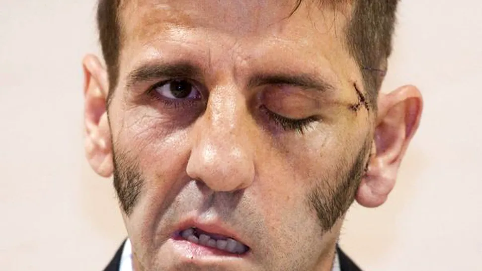 Desfigurat de un taur, toreadorul Juan Jose Padilla vrea din nou in arena! (Video socant)