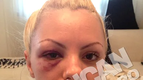 Alexandra Stan: „Managerul meu m-a bătut până m-a băgat în spital”