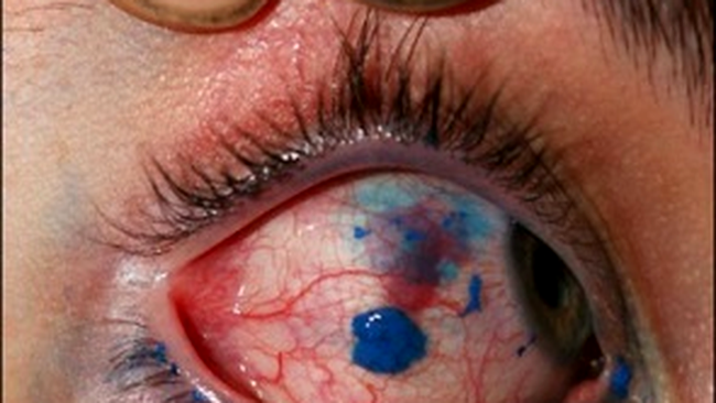 pauly si-a tatuat un ochi 