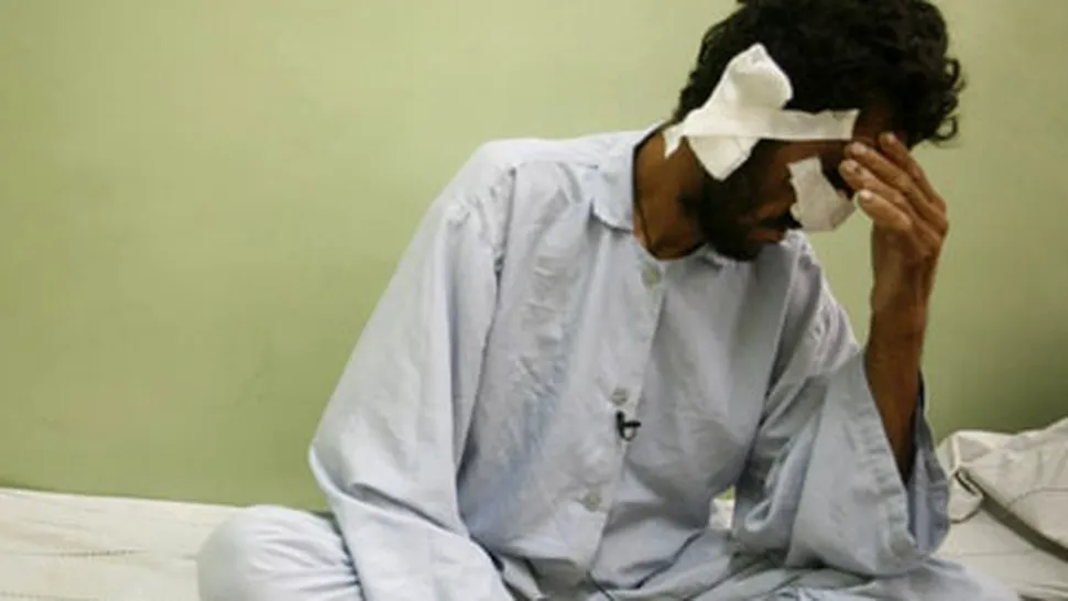 Talibanii i-au taiat nasul si urechile pentru ca a votat (POZE)