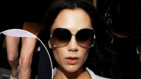 Ce picioare urate are Victoria Beckham!